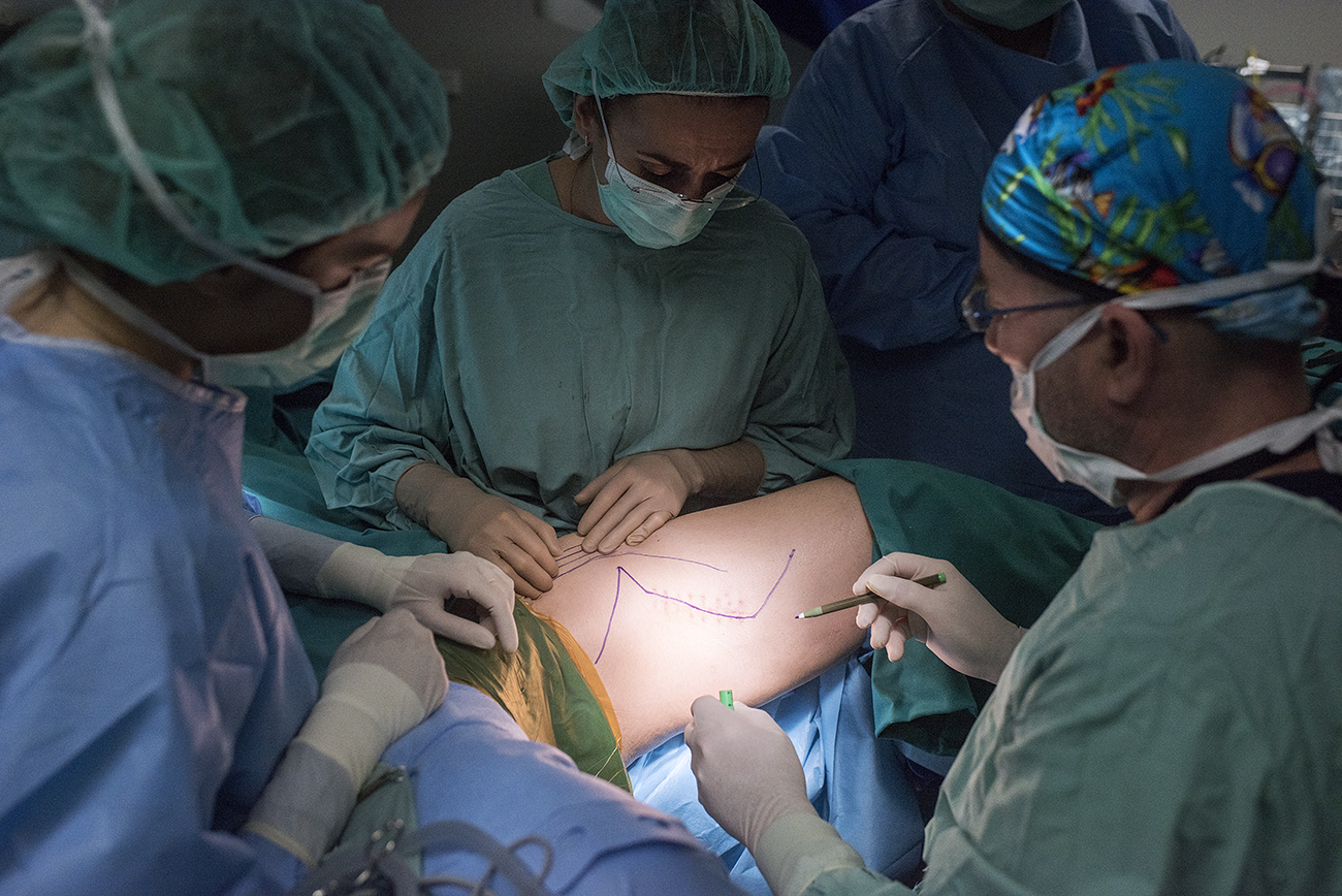 Početak operacije noge, dr. Sanda Smuđ Orehovec obilježava liniju budućeg reza