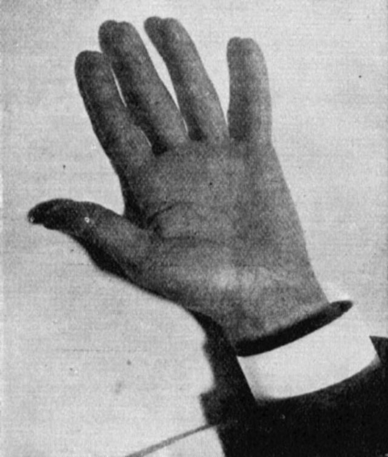 Ruka Nikole Tesle, osvjetljena jednom od njegovih žarulja. Ovo je također prva fotografija uz pomoć "svjetla budućnosti", kako su tada opisivali Tesline žarulje.
