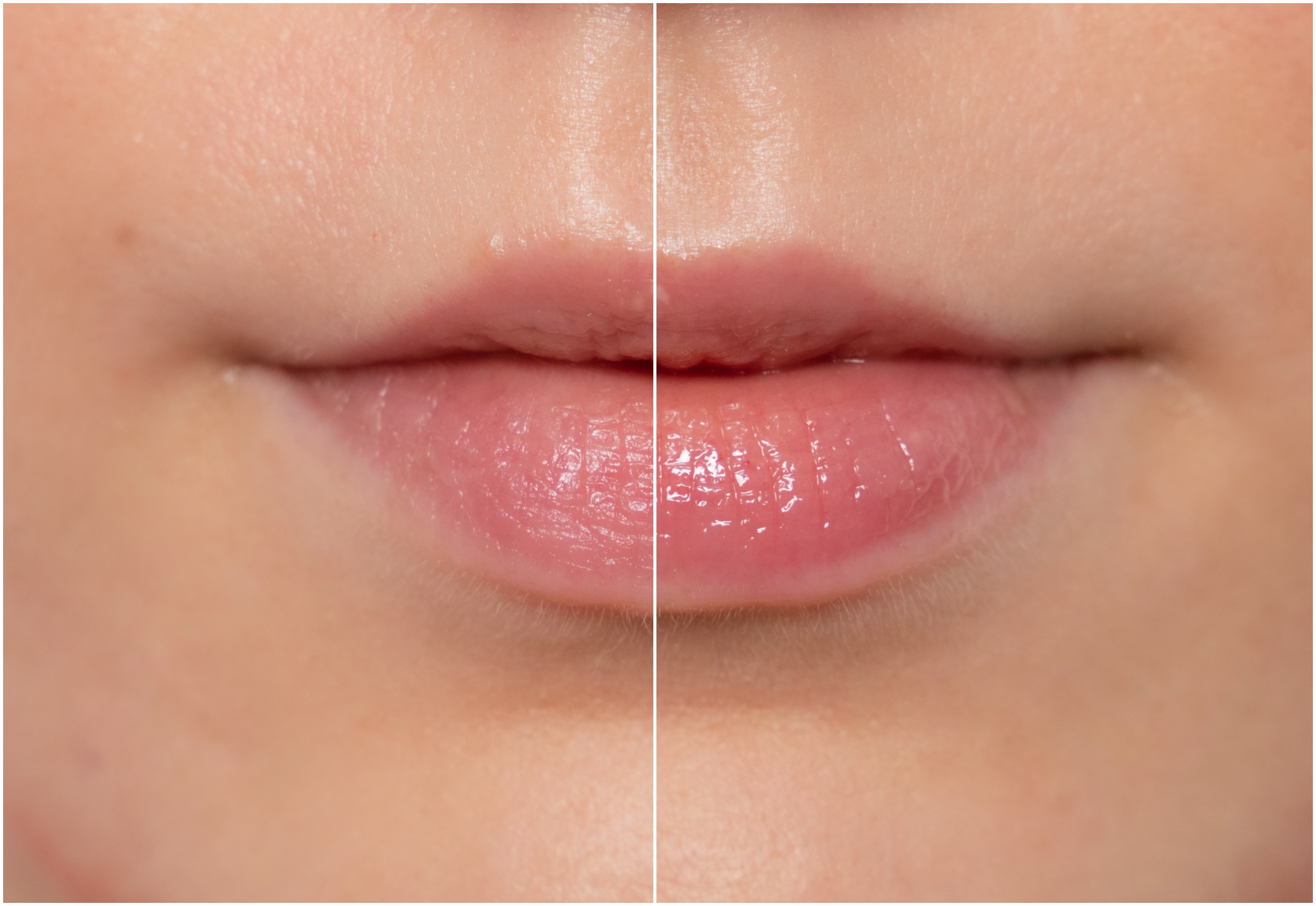 Testirala sam 5 drogerijskih lip plumpera. Evo koji su najbolji | Super1.hr