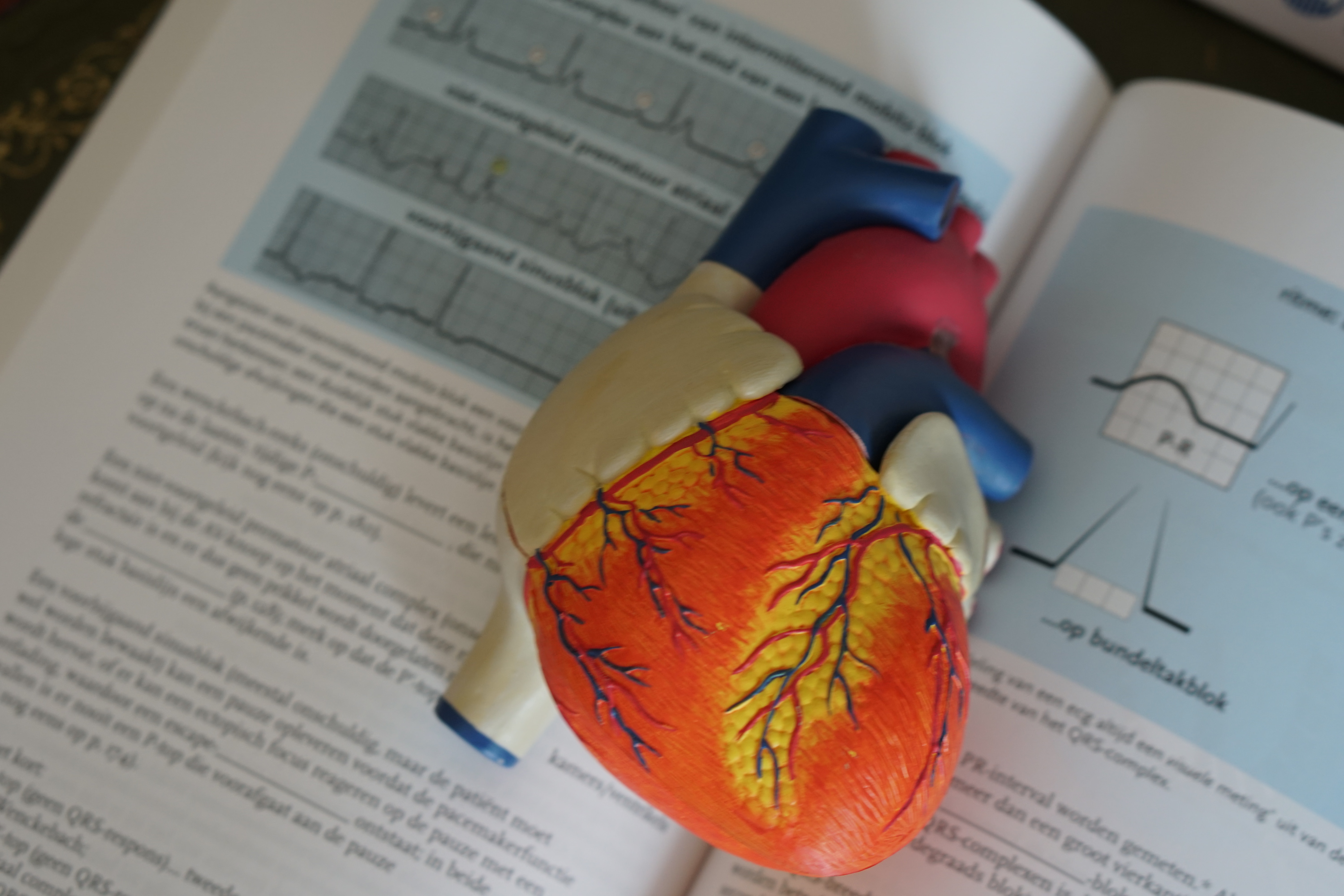 srce i popis namirnica koje začepljuju arterije