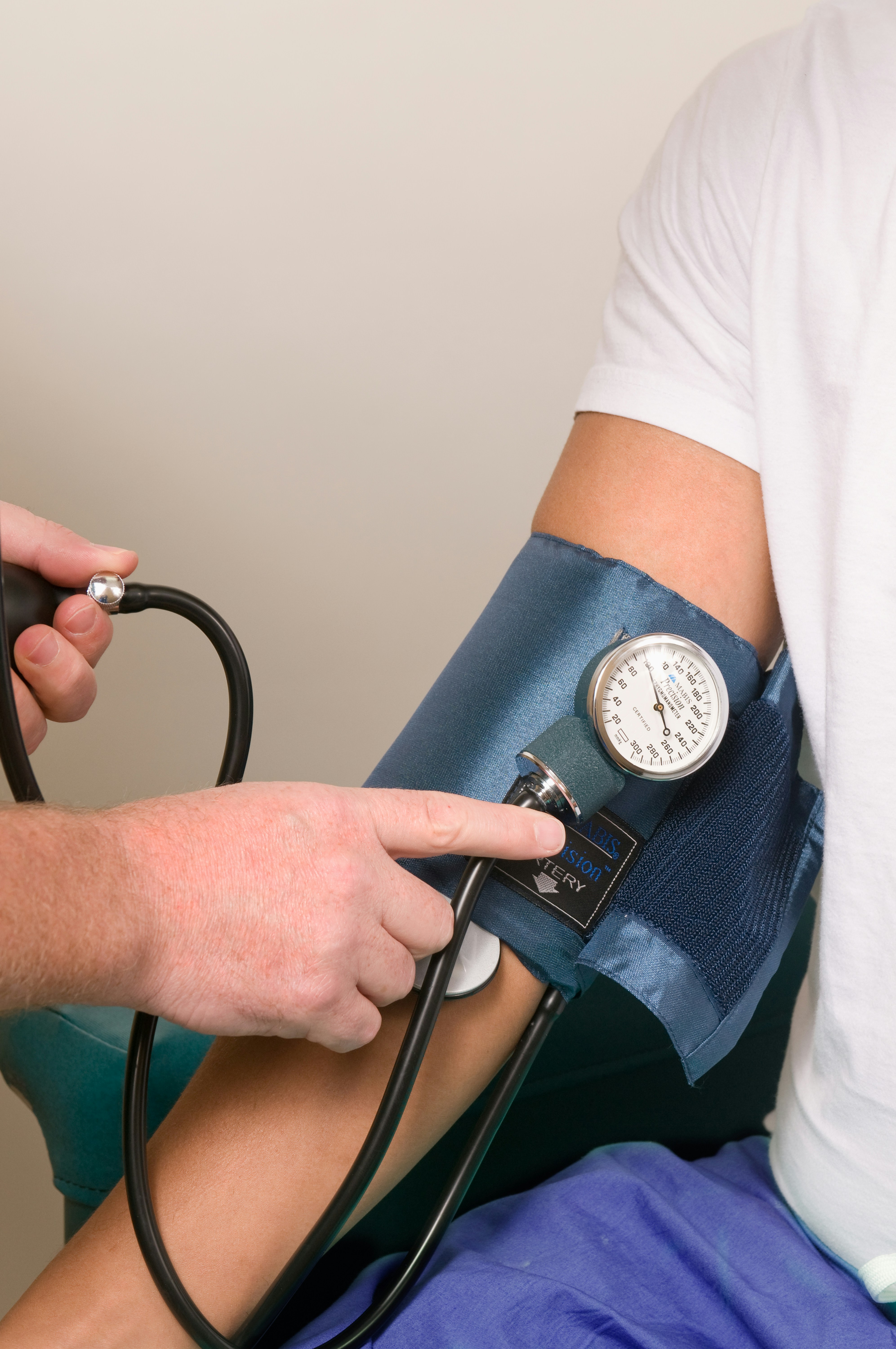 nizak krvni tlak simptomi niskog tlaka liječenje