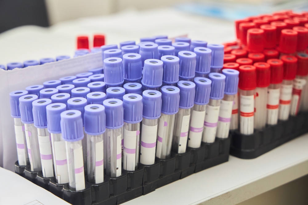 Limfni čvorovi: Uzrok oticanja i znakovi da je stanje ozbiljno ...