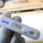 Obećavajući rezultati: cjepivo protiv Lajmske bolesti koju prenose krpelji sve bliže odobrenju