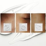 Jedan sastojak koji smiruje akne, crvenilo i osjetljivu kožu? Upoznajte hipoklornu kiselinu