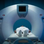 Scanxiety: zašto čekanje nalaza ponekad može iscrpiti više od same dijagnoze