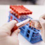 Hepatitis B i C često godinama ne pokazuju simptome: provjerite jeste li u povećanom riziku od infekcije