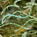 Bakterija Bacillus cereus: simptomi trovanja javljaju se pola sata nakon jela