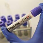 Virus Zapadnog Nila: Ministarstvo objavilo gdje prijaviti pronalazak uginule vrane